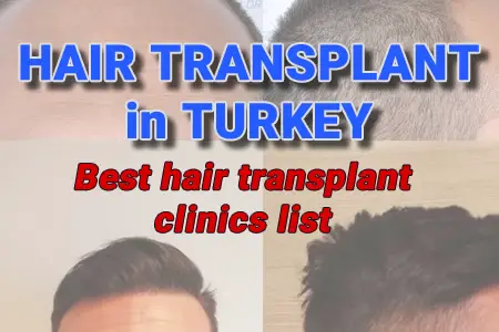 Best Hair Transplant in Turkey: Costs & Guide to Finding Best Turkish Hair Transplant Clinics